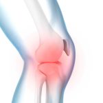 como identificar y tratar la falta de movilidad en la articulacion de la rodilla