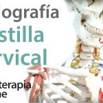 ¿Cuál es el procedimiento para identificar la costilla cervical en una radiografía?