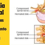 ¿Cuál es la causa de la hernia de disco en la columna cervical?