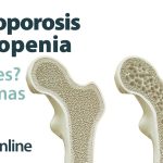 ¿Cuál es la definición de osteoporosis y osteopenia?