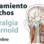 Explorando las causas, efectos y terapias de la neuralgia o occipitalgia de Arnold.