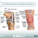 Lesión de rodilla: causas y tratamiento recomendado.