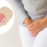 ¿Qué factores afectan la debilidad del suelo pélvico y causan incontinencia urinaria durante el embarazo?
