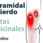 Tratamiento natural con plantas medicinales para el síndrome del músculo piramidal izquierdo.