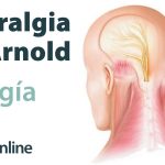 Tratamiento y causas de dolor de cabeza por neuralgia de Arnold.